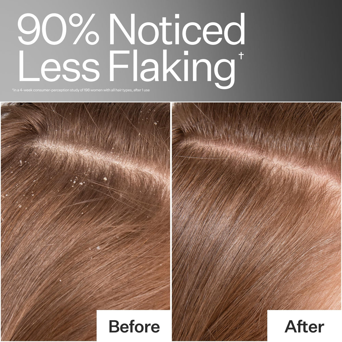 ACT+ ACRE Cold Processed Scalp Detox Oil — Sulfate-Free Scalp Care for Flaky, Dry & Itchy Scalp